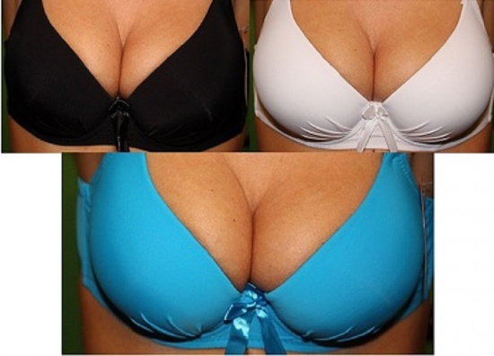 BIELIZNA  damska